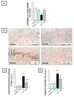 Bax Antibody in Immunohistochemistry (Paraffin) (IHC (P))