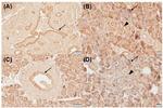 VDR Antibody in Competition Assay (CA)