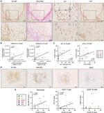 CD20 Antibody in Immunohistochemistry (IHC)