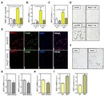 MCP-1 Antibody in Immunohistochemistry (Paraffin) (IHC (P))