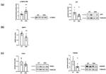 Parkin Antibody in Western Blot (WB)