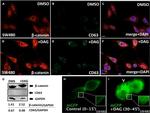 beta Catenin Antibody in Western Blot, Immunocytochemistry (WB, ICC/IF)