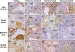 CD20 Antibody in Immunohistochemistry (IHC)