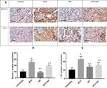 LC3A/LC3B Antibody in Immunohistochemistry (Paraffin) (IHC (P))