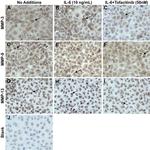 MMP9 Antibody in Immunocytochemistry (ICC/IF)