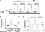 Ankyrin B Antibody in Western Blot (WB)