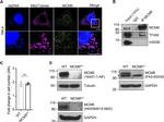 MCM8 Antibody in Western Blot (WB)