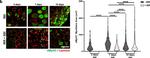 Mouse IgG1 Cross-Adsorbed Secondary Antibody in Immunocytochemistry (ICC/IF)