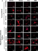 Rabbit IgG (H+L) Cross-Adsorbed Secondary Antibody in Immunocytochemistry (ICC/IF)