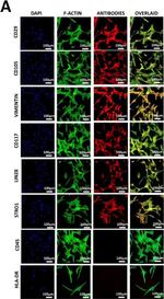 Rabbit IgG (H+L) Cross-Adsorbed Secondary Antibody in Immunocytochemistry (ICC/IF)