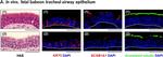 Rabbit IgG (H+L) Highly Cross-Adsorbed Secondary Antibody in Immunohistochemistry (IHC)