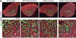 Mouse IgG1 Cross-Adsorbed Secondary Antibody in Immunohistochemistry (IHC)