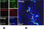 Rabbit IgG (H+L) Highly Cross-Adsorbed Secondary Antibody in Immunohistochemistry (IHC)