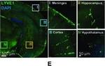 Goat IgG (H+L) Cross-Adsorbed Secondary Antibody in Immunohistochemistry (IHC)