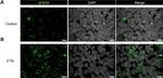 Rabbit IgG (H+L) Cross-Adsorbed Secondary Antibody in Immunohistochemistry (IHC)