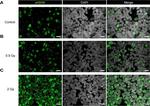 Rabbit IgG (H+L) Cross-Adsorbed Secondary Antibody in Immunohistochemistry (IHC)