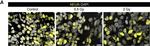 Mouse IgG (H+L) Highly Cross-Adsorbed Secondary Antibody in Immunohistochemistry (IHC)