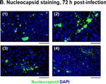 Mouse IgG (H+L) Highly Cross-Adsorbed Secondary Antibody in Immunohistochemistry (Paraffin) (IHC (P))