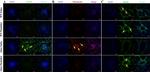 Goat IgG (H+L) Cross-Adsorbed Secondary Antibody in Immunohistochemistry (IHC)