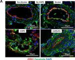 Rabbit IgG (H+L) Highly Cross-Adsorbed Secondary Antibody in Immunohistochemistry (IHC)