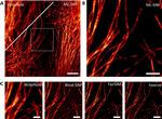 Mouse IgG1 Cross-Adsorbed Secondary Antibody in Immunocytochemistry (ICC/IF)