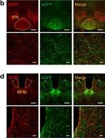 Goat IgG (H+L) Cross-Adsorbed Secondary Antibody in Immunohistochemistry (IHC)