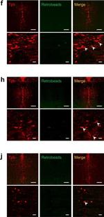 Sheep IgG (H+L) Cross-Adsorbed Secondary Antibody in Immunohistochemistry (IHC)