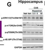 Rabbit IgG (H+L) Highly Cross-Adsorbed Secondary Antibody in Western Blot (WB)