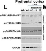 Rabbit IgG (H+L) Highly Cross-Adsorbed Secondary Antibody in Western Blot (WB)