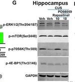 Rabbit IgG (H+L) Highly Cross-Adsorbed Secondary Antibody in Western Blot (WB)