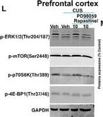 Rabbit IgG (H+L) Highly Cross-Adsorbed Secondary Antibody in Western Blot (WB)