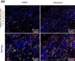 Mouse IgG (H+L) Highly Cross-Adsorbed Secondary Antibody in Immunocytochemistry (ICC/IF)