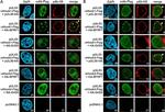 Mouse IgG (H+L) Cross-Adsorbed Secondary Antibody in Immunocytochemistry (ICC/IF)