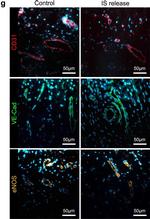 Rabbit IgG (H+L) Cross-Adsorbed Secondary Antibody in Immunohistochemistry (IHC)