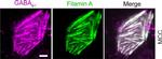 Rabbit IgG (H+L) Highly Cross-Adsorbed Secondary Antibody in Immunohistochemistry (IHC)