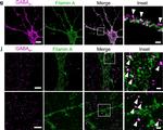 Rabbit IgG (H+L) Highly Cross-Adsorbed Secondary Antibody in Immunohistochemistry (IHC)