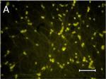 Rabbit IgG (H+L) Highly Cross-Adsorbed Secondary Antibody in Immunocytochemistry (ICC/IF)