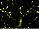 Rabbit IgG (H+L) Highly Cross-Adsorbed Secondary Antibody in Immunocytochemistry (ICC/IF)