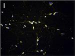 Rabbit IgG (H+L) Highly Cross-Adsorbed Secondary Antibody in Immunocytochemistry (ICC/IF)