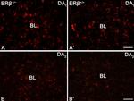 Rabbit IgG (H+L) Highly Cross-Adsorbed Secondary Antibody in Immunohistochemistry (IHC)