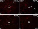 Rabbit IgG (H+L) Highly Cross-Adsorbed Secondary Antibody in Immunohistochemistry (IHC)