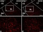 Rabbit IgG (H+L) Highly Cross-Adsorbed Secondary Antibody in Immunohistochemistry (IHC)