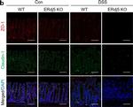 Rabbit IgG (H+L) Cross-Adsorbed Secondary Antibody in Immunocytochemistry (ICC/IF)