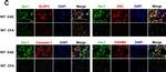 Mouse IgG (H+L) Highly Cross-Adsorbed Secondary Antibody in Immunohistochemistry (IHC)