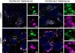 Rabbit IgG (H+L) Highly Cross-Adsorbed Secondary Antibody in Immunocytochemistry (ICC/IF)