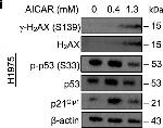 Rabbit IgG (H+L) Secondary Antibody in Western Blot (WB)