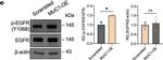 Rabbit IgG (H+L) Secondary Antibody in Western Blot (WB)