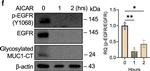 Mouse IgG (H+L) Highly Cross-Adsorbed Secondary Antibody in Immunocytochemistry (ICC/IF)