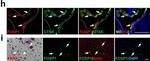 Rabbit IgG (H+L) Highly Cross-Adsorbed Secondary Antibody in Immunohistochemistry (IHC)