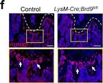 Rabbit IgG (H+L) Highly Cross-Adsorbed Secondary Antibody in Immunohistochemistry (IHC)